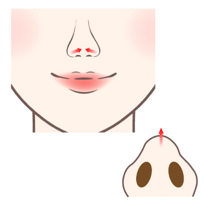 鼻先を細くする施術のイメージ