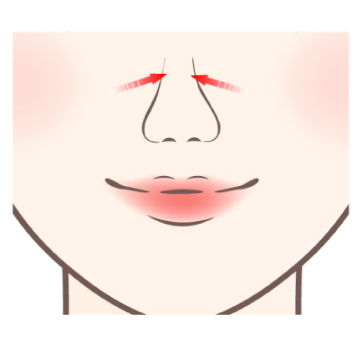 鼻筋を整える施術のイメージ