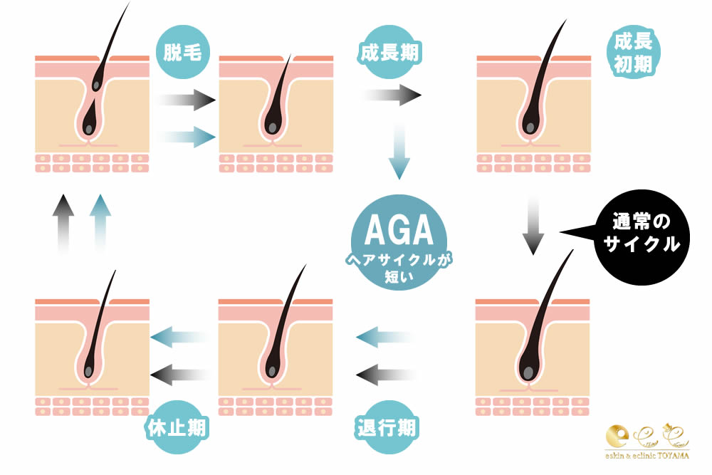 AGAのヘアサイクルの図解