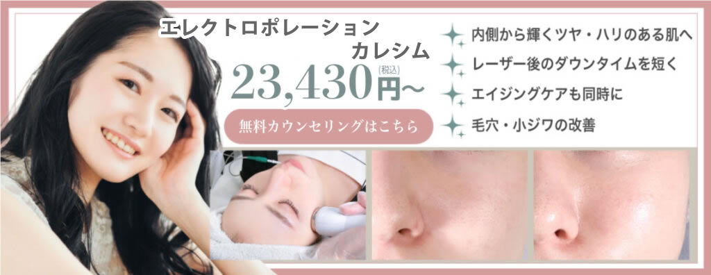 エレクトロポレーションカレシムバナー