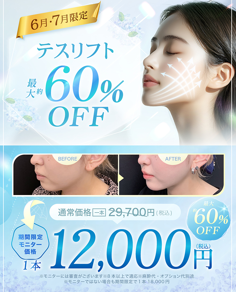 テスリフトのモニターキャンペーン