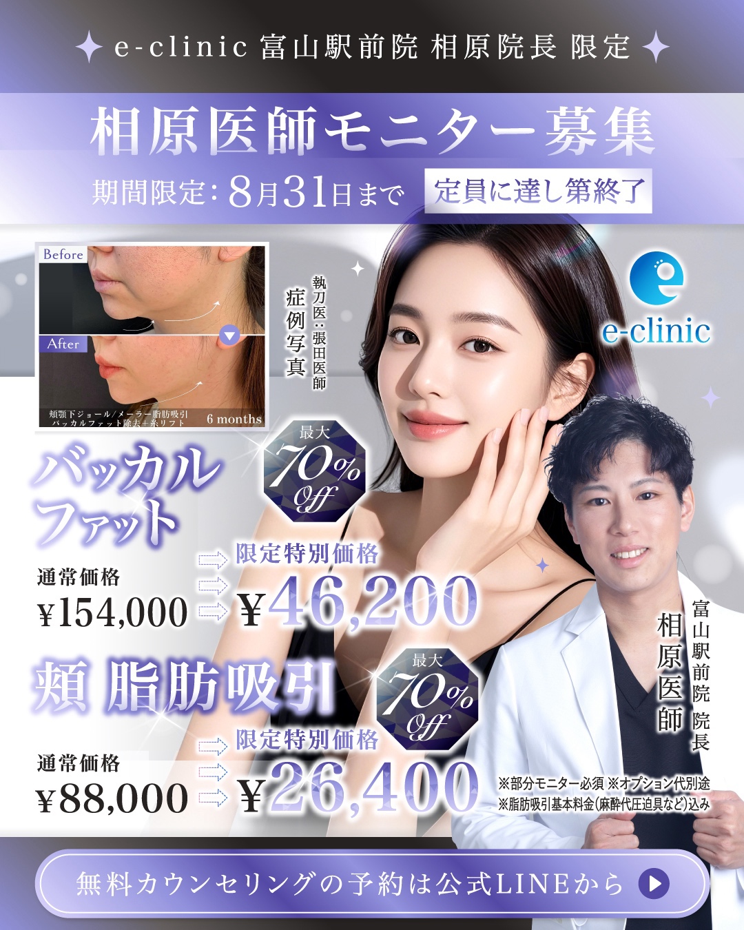 バッカルファットのモニター募集のバナー