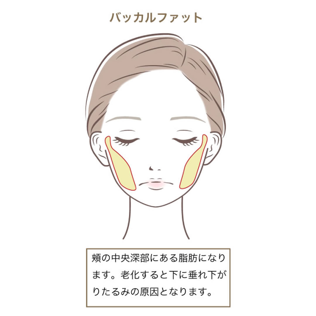 バッカルファットの図解