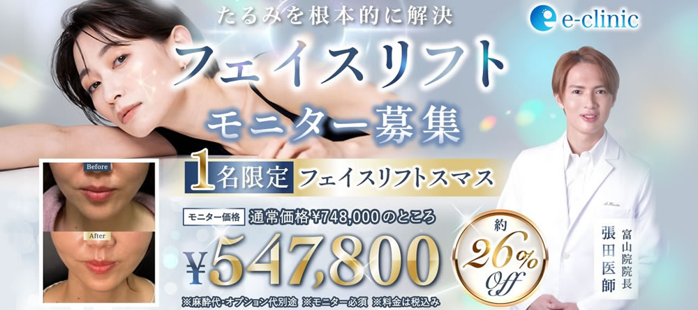 フェイスリフトのバナー