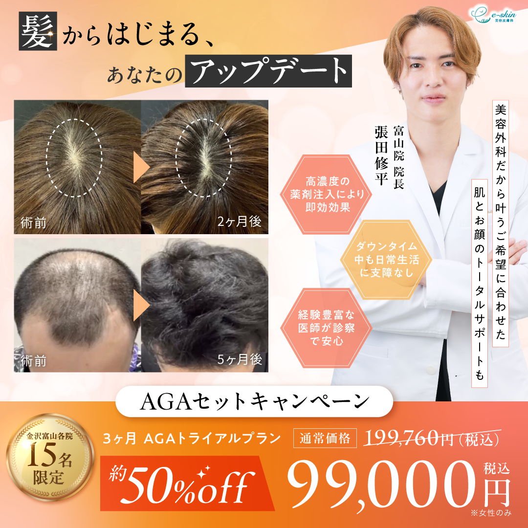 AGAのキャンペーンバナー