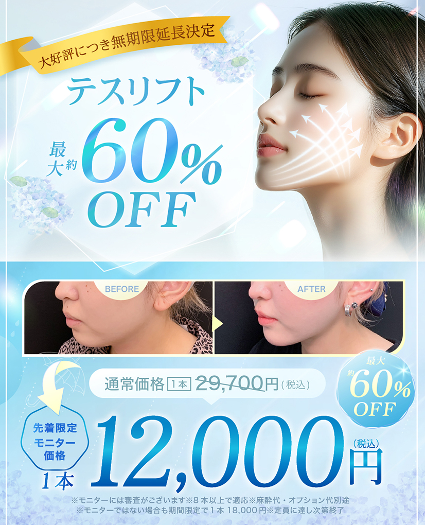 テスリフト