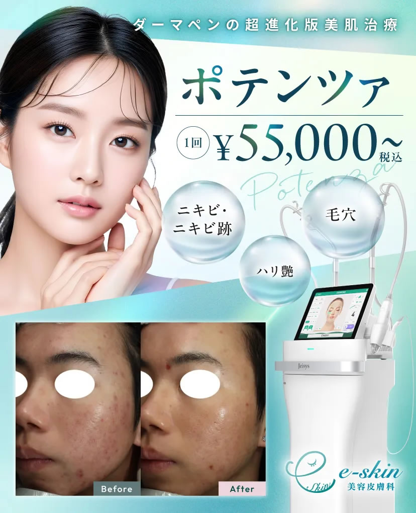 ポテンツァのスマフォバナー