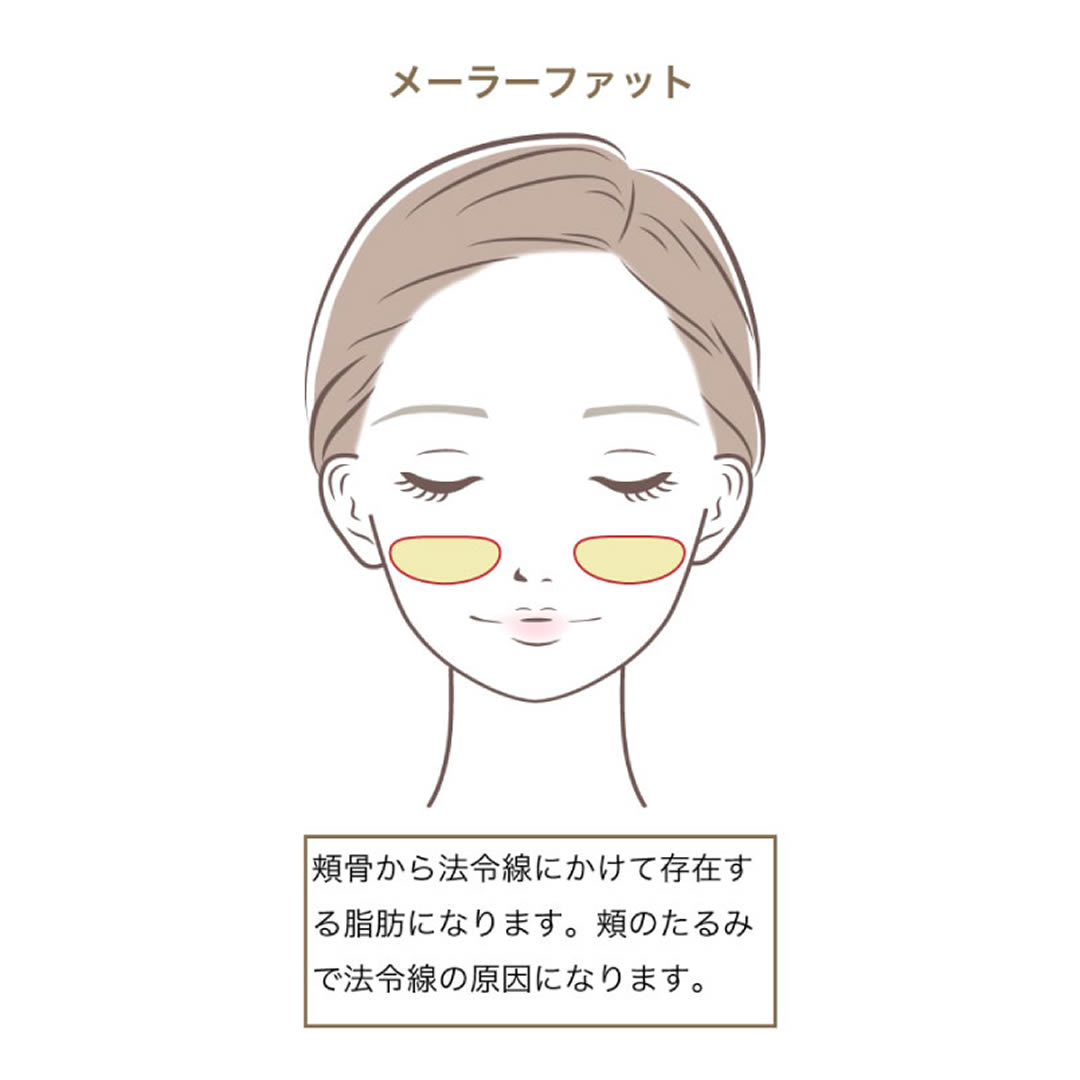 メーラーファット除去の図解