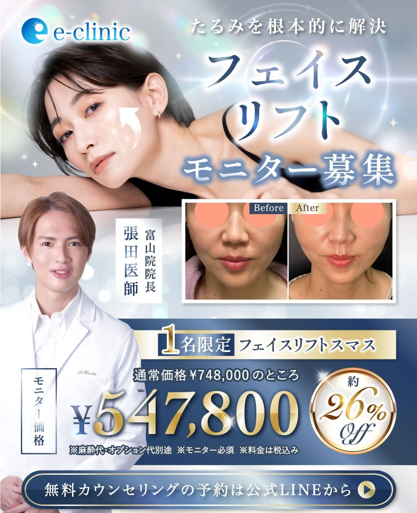 フェイスリフトのバナー