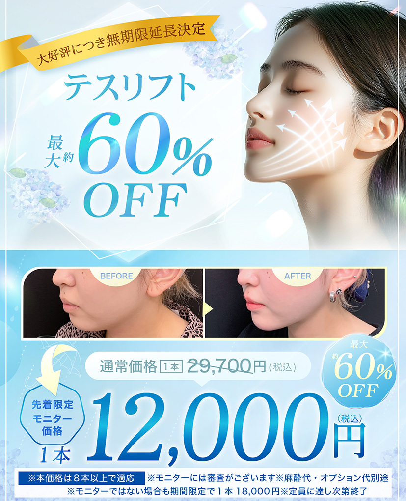テスリフト