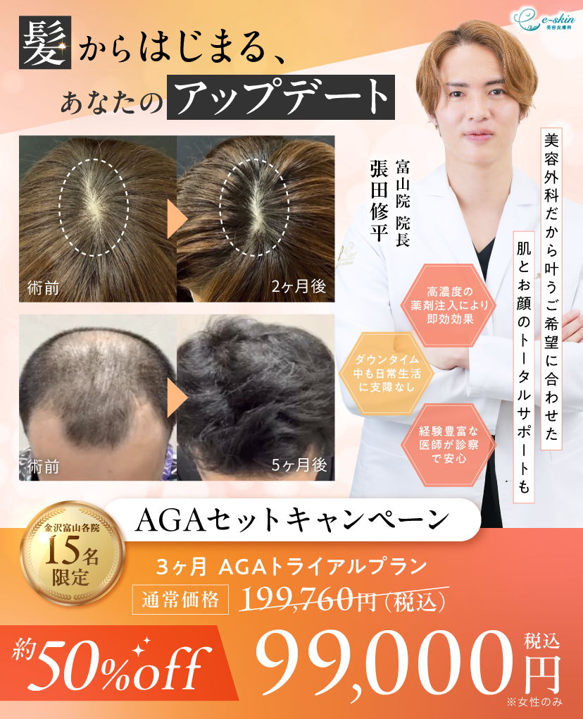 AGAのバナー