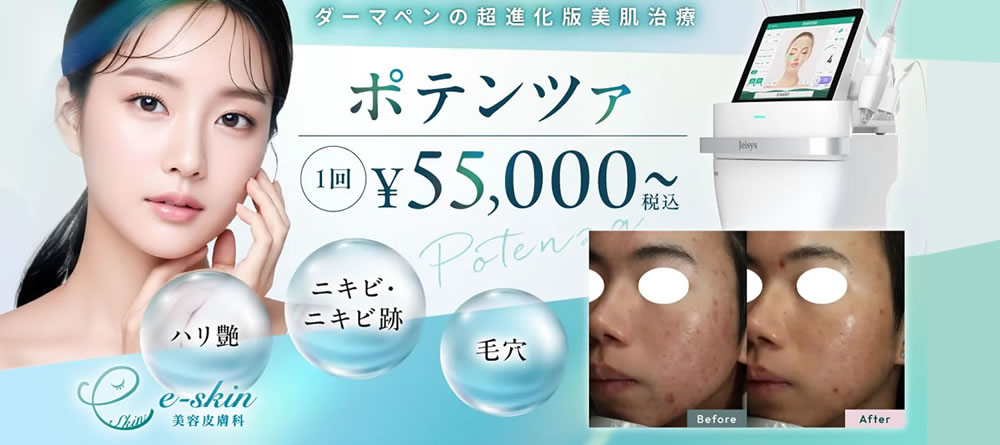 ポテンツァのバナー