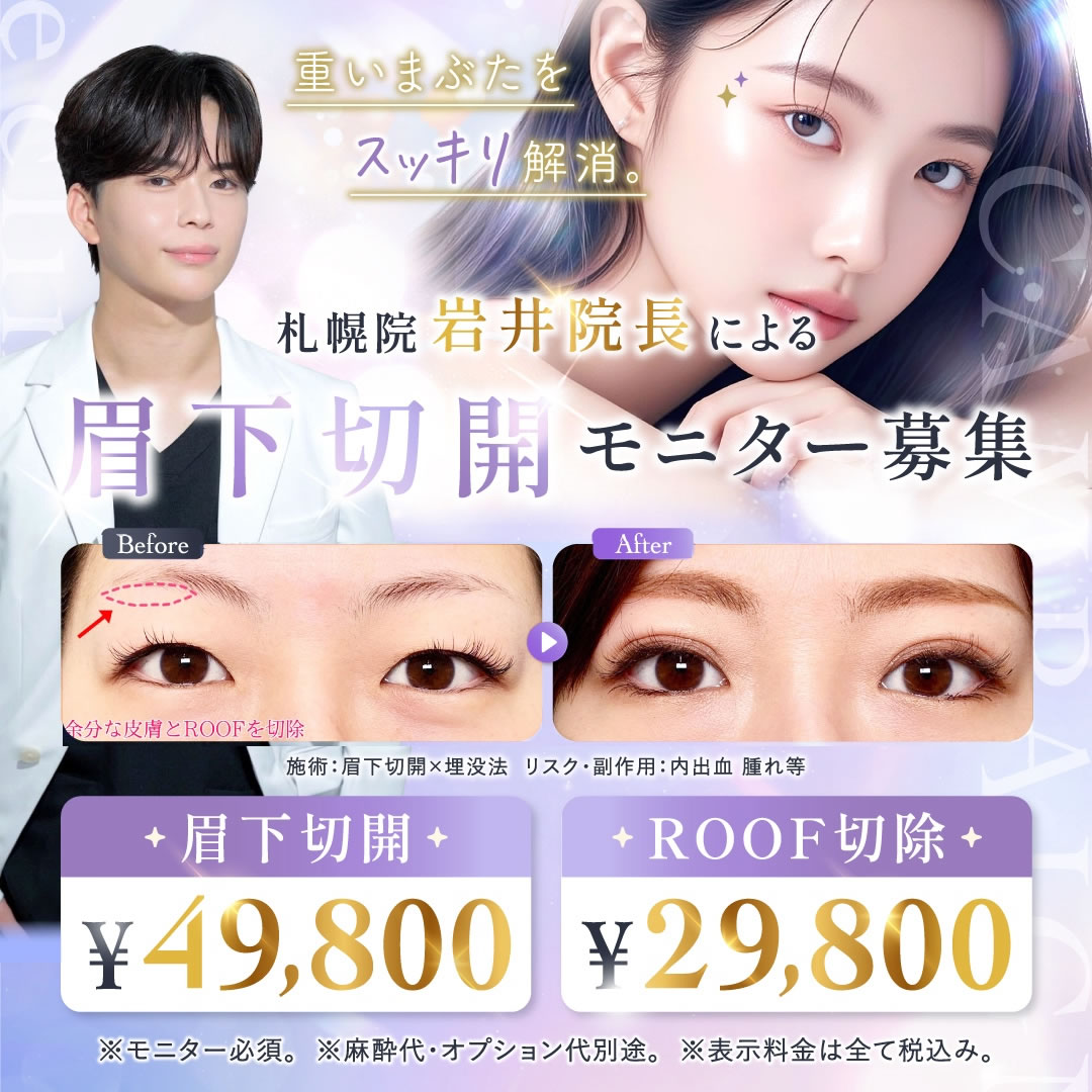 眉下切開のバナー
