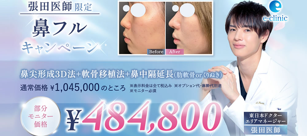 富山院の鼻フルのキャンペーンバナー