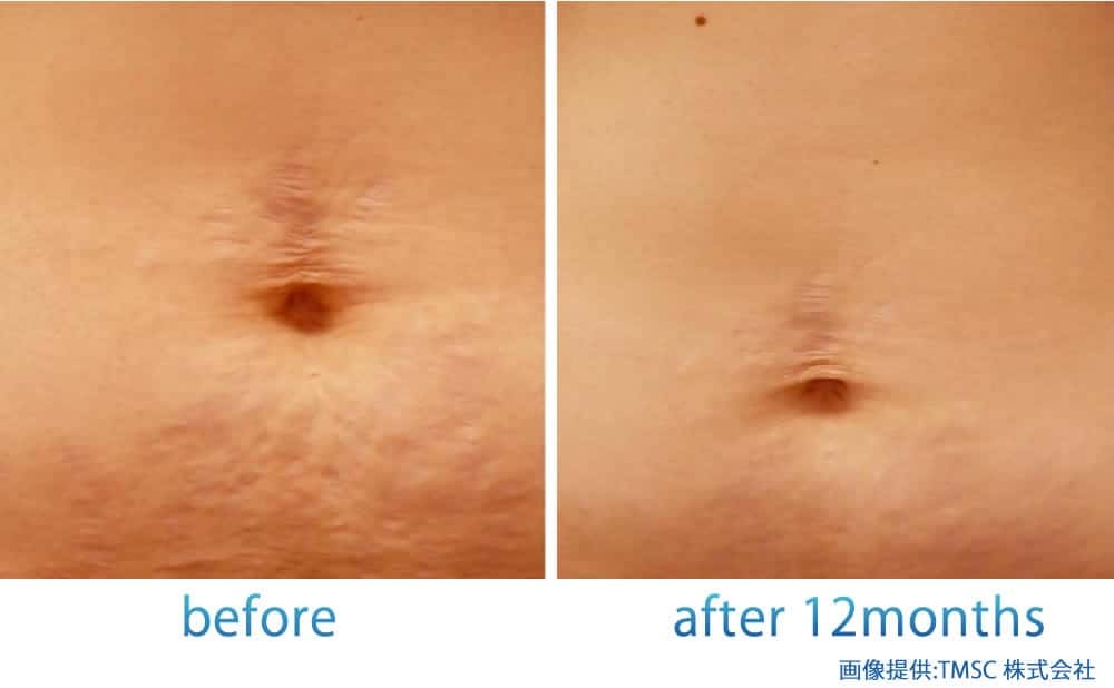 リジェネラの症例写真 (6)