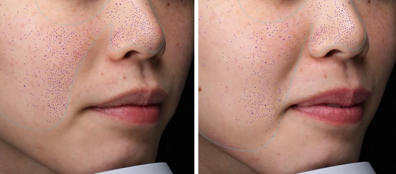 肉眼では確認できない肌トラブルを可視化しているイメージ