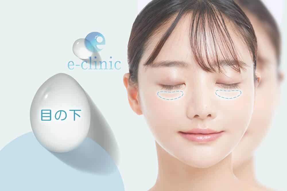 目の下の部位