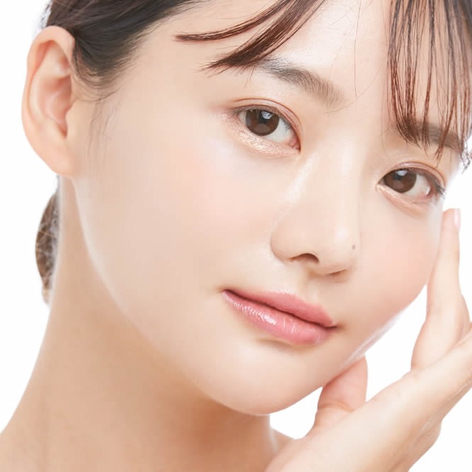 涙袋にヒアルロン酸を注入した女性