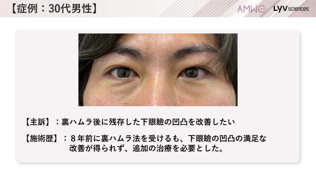 12_症例：30代男性